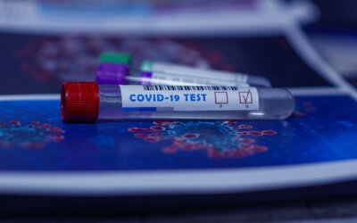 Uaktualnienie: OBOWIĄZKOWE TESTY PCR PRZY WJEŹDZIE DO POLSKI ZE WSCHODU – DOTYCZY RÓWNIEŻ KIEROWCÓW